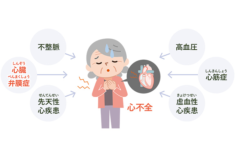 心不全とは②